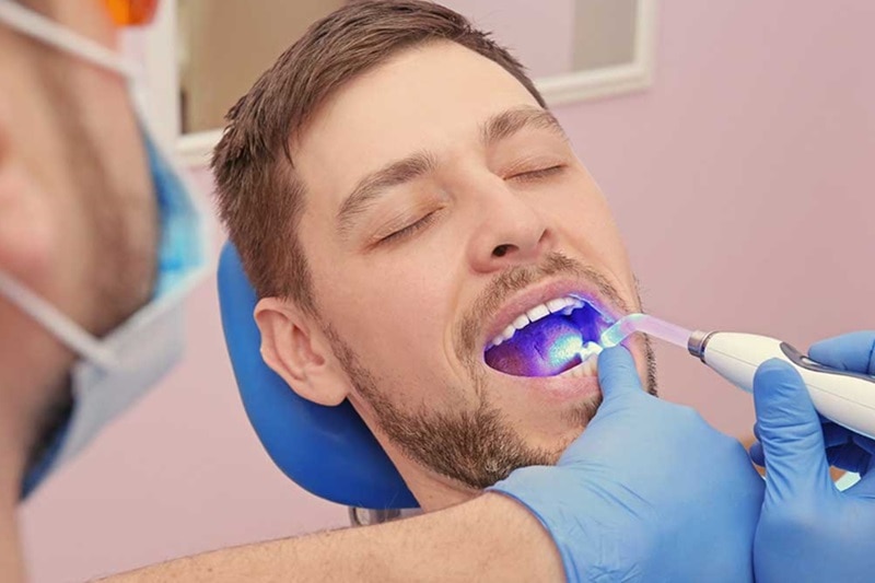 Dental Filling Ser Img